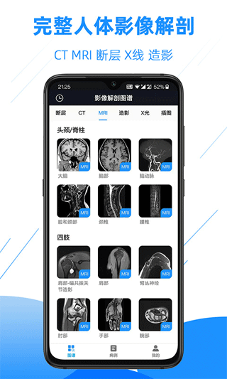 影像解剖图谱app1