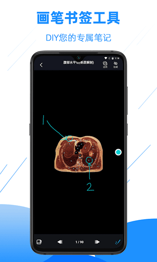 影像解剖图谱app5